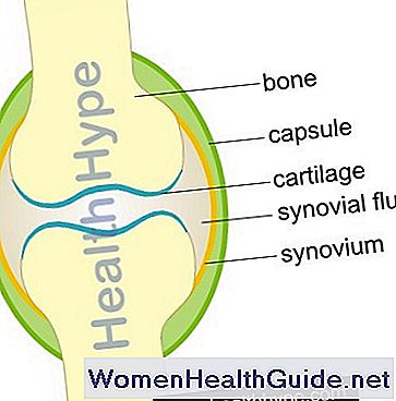 Osteoartrite (artrite dell'osso osseo) collo, schiena, anca, ginocchio