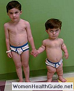 Acondroplasia
