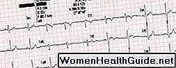 8 test di attacco cardiaco con immagini