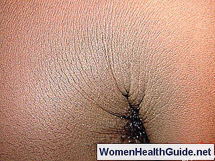 Acanthosis Nigricans (Dark Thick Skin Folds) Cause e immagini