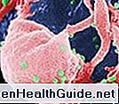 Domande frequenti sul paziente All About AIDS (Sindrome da immunodeficienza acquisita)