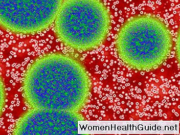 Infezione da HIV Enteropatia (HIV / AIDS), intestino tenue