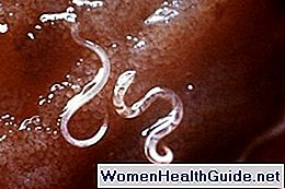 Roundworms (Nematode Infezione) Tipi, sintomi, trattamento