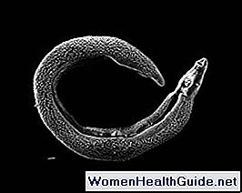 Schistosomiasi (Schistosome Blood Fluke, Bilharzia Worms)