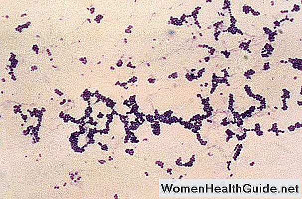Diagnosi Staph (test di laboratorio) ed epidemiologia (dove vive)