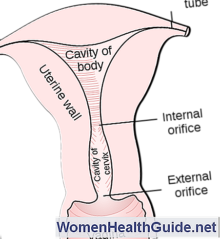 ¿Qué es el cáncer de cuello uterino? Ubicación, pre-cancerígenos, patrones de crecimiento
