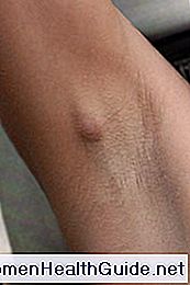 lymph nodes armpit lymph nodes armpit