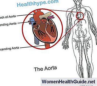 Aneurisma aórtico (AA) - Tipos de aneurismas torácicos y abdominales
