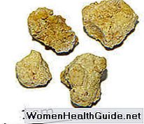Pietra delle ghiandole salivari - Sintomi, trattamento delle pietre nel condotto