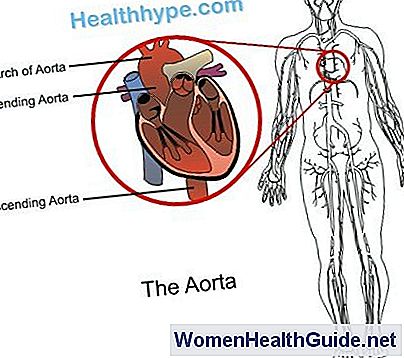 AORT DISEKSIYONU DOWNLOAD AORT DISEKSIYONU DOWNLOAD